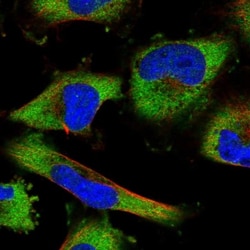 LARP5 Antibody, Novus Biologicals 25 &mu;L; Unlabeled:Antibodies, Polyclonal